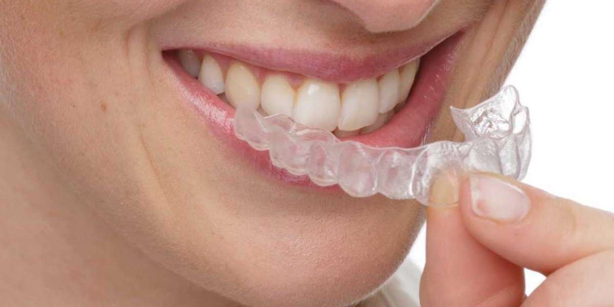 İnvisalign Tedavisi Nedir? Apareyler Ne İşe Yarar? İnvisalign Nedir?